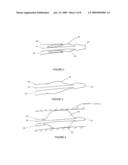 Drug Coated Balloon Catheter diagram and image