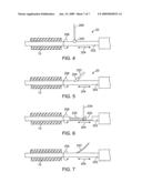 MINIMALLY INVASIVE METHODS AND DEVICES FOR THE TREATMENT OF PROSTATE DISEASES diagram and image