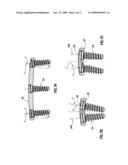 Multi-axis connection and methods for internal spinal stabilizers diagram and image