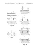 METHOD FOR FASTENING AN IMPLANT TO BONE TISSUE AND CORRESPONDING IMPLANT SYSTEM diagram and image