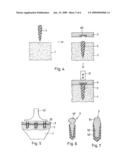 METHOD FOR FASTENING AN IMPLANT TO BONE TISSUE AND CORRESPONDING IMPLANT SYSTEM diagram and image