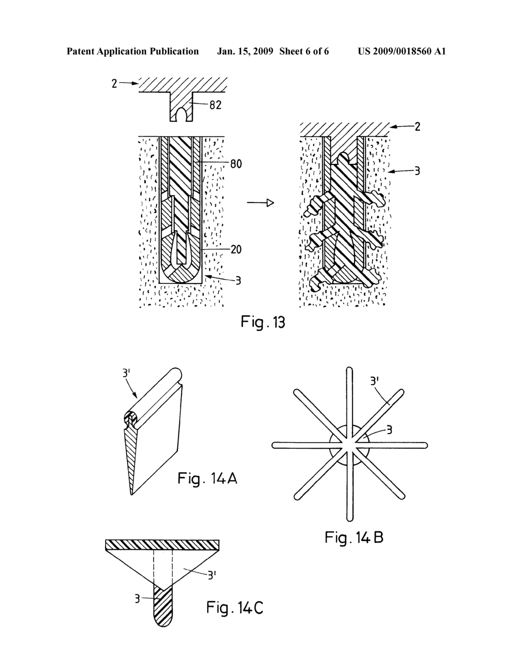 METHOD FOR FASTENING AN IMPLANT TO BONE TISSUE AND CORRESPONDING IMPLANT SYSTEM - diagram, schematic, and image 07
