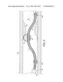 Rotational Device with Eccentric Abrasive Element and Method of Use diagram and image