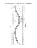 Rotational Device with Eccentric Abrasive Element and Method of Use diagram and image