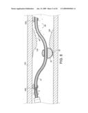 Rotational Device with Eccentric Abrasive Element and Method of Use diagram and image