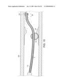 Rotational Device with Eccentric Abrasive Element and Method of Use diagram and image