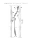 Rotational Device with Eccentric Abrasive Element and Method of Use diagram and image