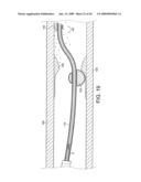 Rotational Device with Eccentric Abrasive Element and Method of Use diagram and image