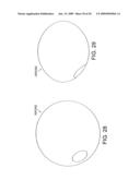 Rotational Device with Eccentric Abrasive Element and Method of Use diagram and image