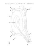 Wound closure product diagram and image