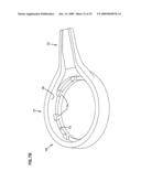 Wound closure product diagram and image