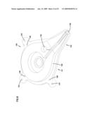 Wound closure product diagram and image