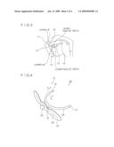 Lip Closing Tool diagram and image