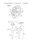 FACET ARTHROPLASTY DEVICES AND METHODS diagram and image