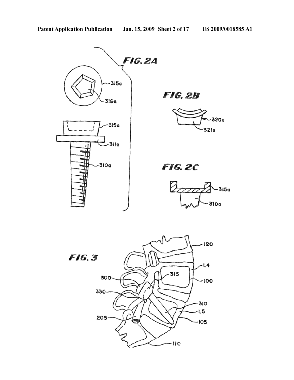 FACET ARTHROPLASTY DEVICES AND METHODS - diagram, schematic, and image 03