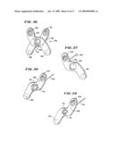 FACET ARTHROPLASTY DEVICES AND METHODS diagram and image