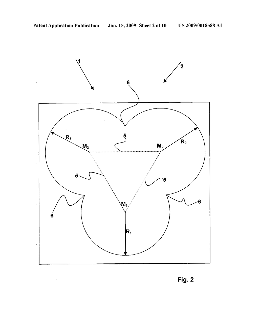 Orthopedic screw fastener system - diagram, schematic, and image 03