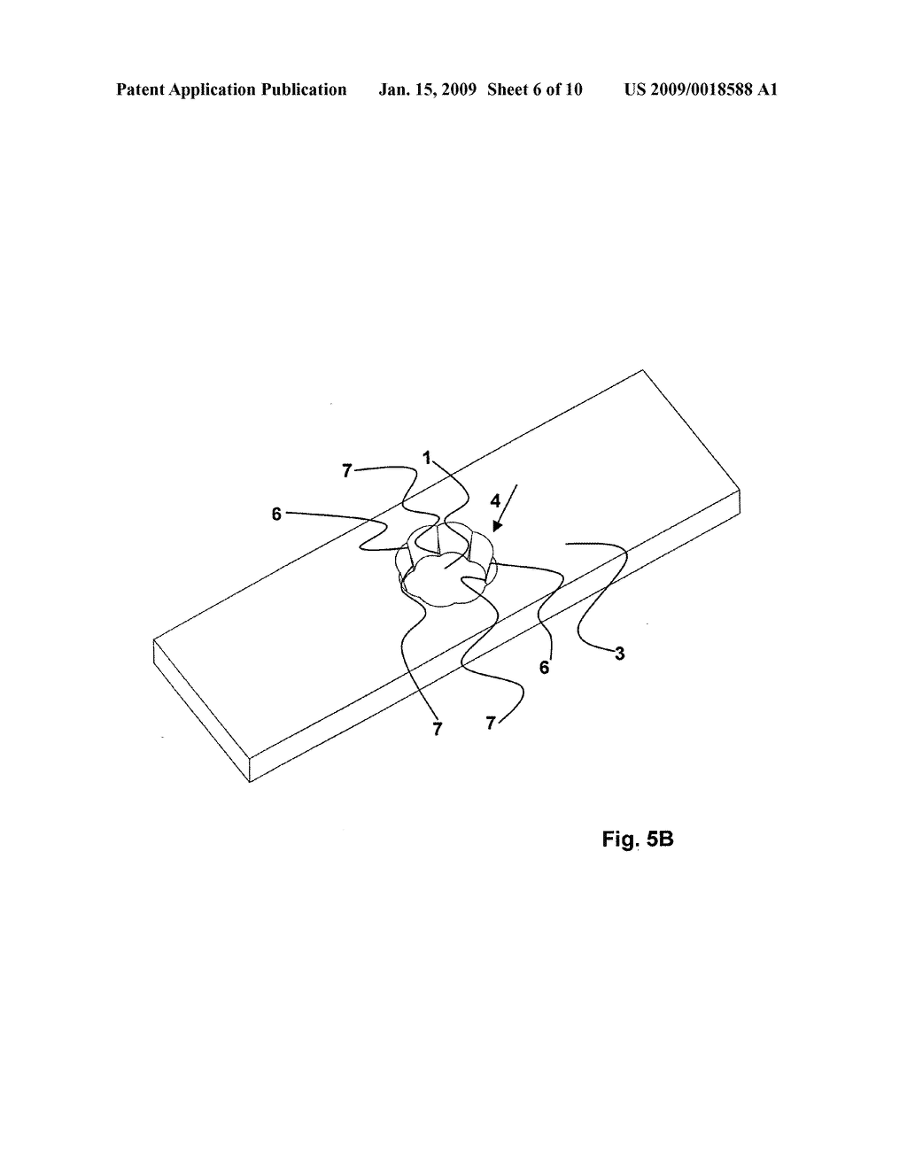 Orthopedic screw fastener system - diagram, schematic, and image 07