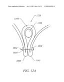 METHODS AND DEVICES FOR MEDICAL TREATMENT diagram and image