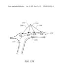 METHODS AND DEVICES FOR MEDICAL TREATMENT diagram and image