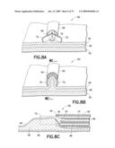 Methods And Systems for Submucosal Implantation of a Device For Diagnosis and Treatment with a Therapeutic Agent diagram and image