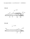 Methods And Systems for Submucosal Implantation of a Device For Diagnosis and Treatment with a Therapeutic Agent diagram and image