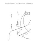 REGULATION OF VASCULAR ENDOTHELIAL GROWTH FACTOR (VEGF) GENE EXPRESSION IN TISSUE VIA THE APPLICATION OF ELECTRIC AND/OR ELECTROMAGNETIC FIELDS diagram and image