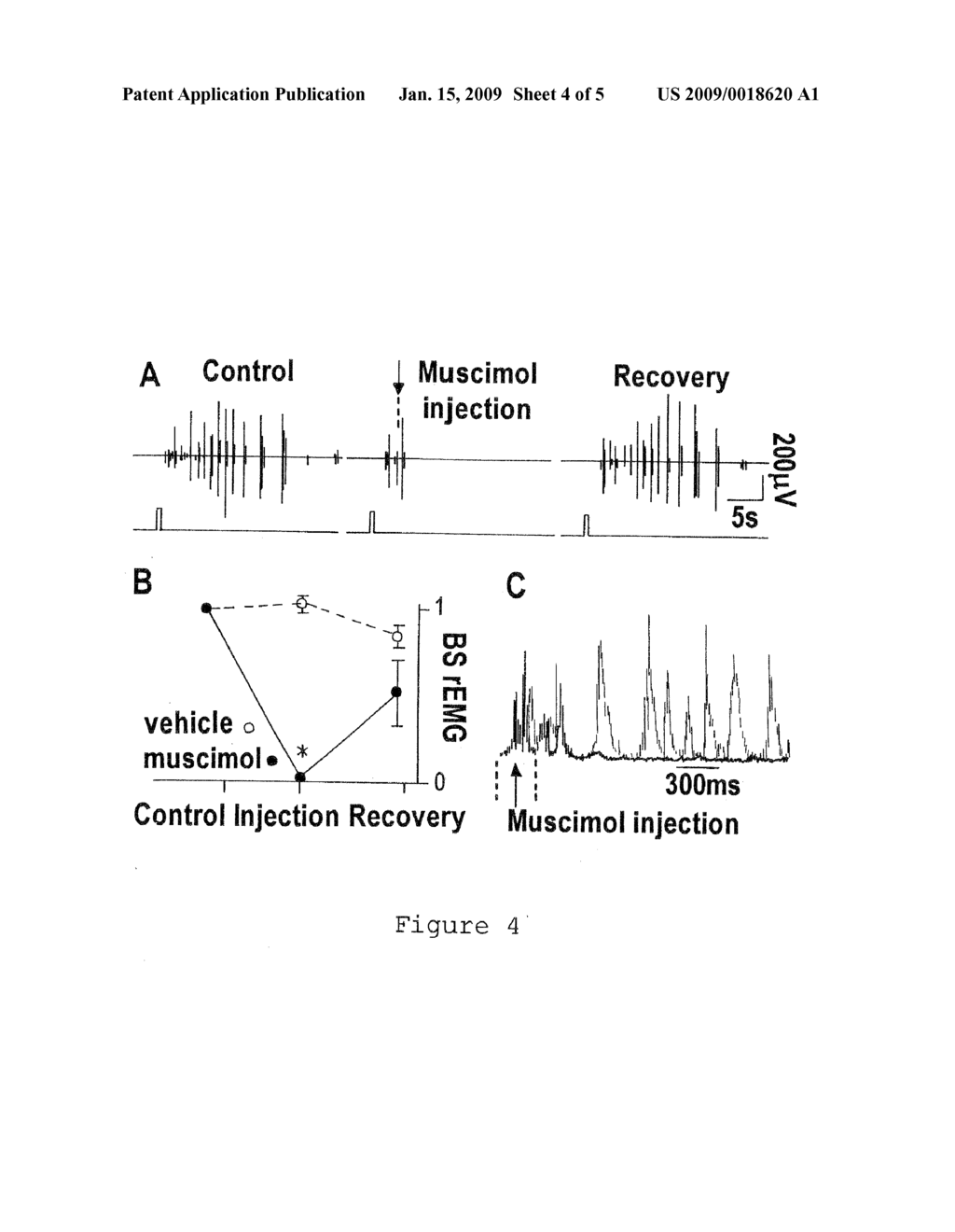 METHOD FOR RESTORING AN EJACULATORY FAILURE - diagram, schematic, and image 05