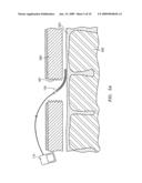 SELF-EXPANDABLE EPIDURAL CORTICAL ELECTRODE diagram and image