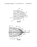 Methods and apparatus for rapid endovascular vessel occlusion and blood flow interruption diagram and image