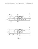 Methods and apparatus for rapid endovascular vessel occlusion and blood flow interruption diagram and image