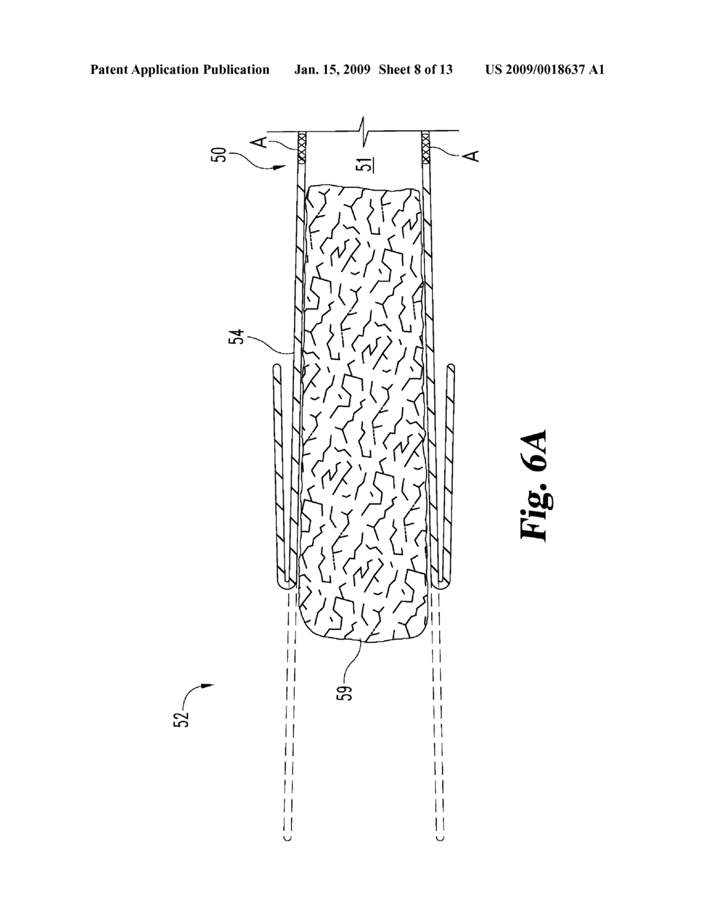 TUBULAR DEVICES HAVING REVERSIBLE COMPONENTS FOR DEPLOYMENT OF ENDOLUMINAL OCCLUDERS AND RELATED METHODS AND SYSTEMS - diagram, schematic, and image 09