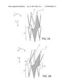 LARGE VESSEL STENTS diagram and image