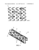 Boron-Enhanced Shape Memory Endoprostheses diagram and image