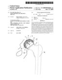 Set For Creating An Offset-Resurfacing Hip-Joint Implant diagram and image