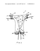 Easy Donning Garment diagram and image