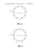 Retaining Ring with Shaped Profile diagram and image