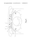 CHAIR BACKREST MOUNTING BRACKET diagram and image