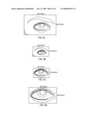Display of Ocular Movement diagram and image