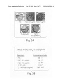 Nanoparticle and polymer formulations for thyroid hormone analogs, antagonists and formulations and uses thereof diagram and image