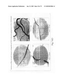 Nanoparticle and polymer formulations for thyroid hormone analogs, antagonists and formulations and uses thereof diagram and image