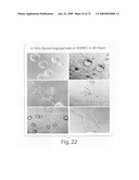 Nanoparticle and polymer formulations for thyroid hormone analogs, antagonists and formulations and uses thereof diagram and image