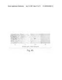 Nanoparticle and polymer formulations for thyroid hormone analogs, antagonists and formulations and uses thereof diagram and image