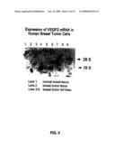 Vascular endothelial growth factor 2 diagram and image