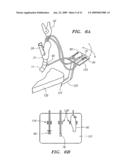 ENDOLUMINAL INSTRUMENT MANAGEMENT SYSTEM diagram and image