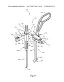 SURGICAL MEASUREMENT AND RESECTION FRAMEWORK diagram and image