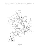 SURGICAL MEASUREMENT AND RESECTION FRAMEWORK diagram and image