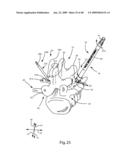 SURGICAL MEASUREMENT AND RESECTION FRAMEWORK diagram and image