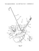 SURGICAL MEASUREMENT AND RESECTION FRAMEWORK diagram and image