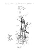 SURGICAL MEASUREMENT AND RESECTION FRAMEWORK diagram and image